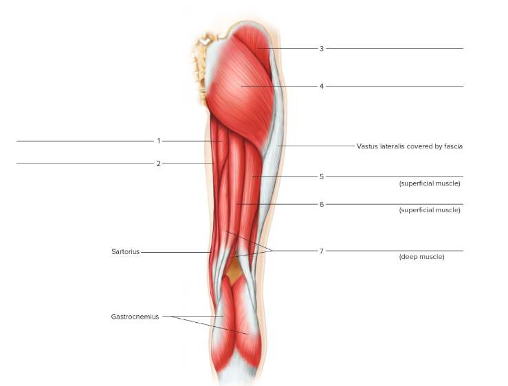 <p>Label the following: Posterior right hip and thigh</p>
