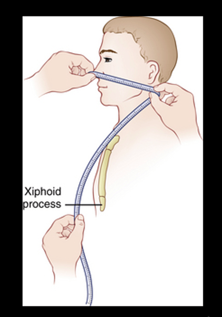 <p>nasogastric tube (nose)</p>