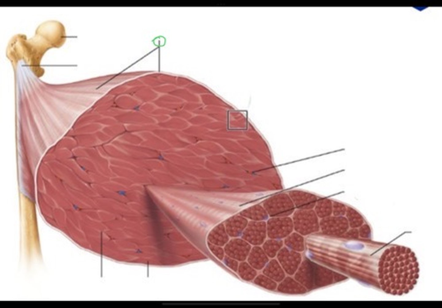 <p>CT surrounding entire muscle</p>