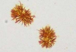 <p>Clumped needles</p>