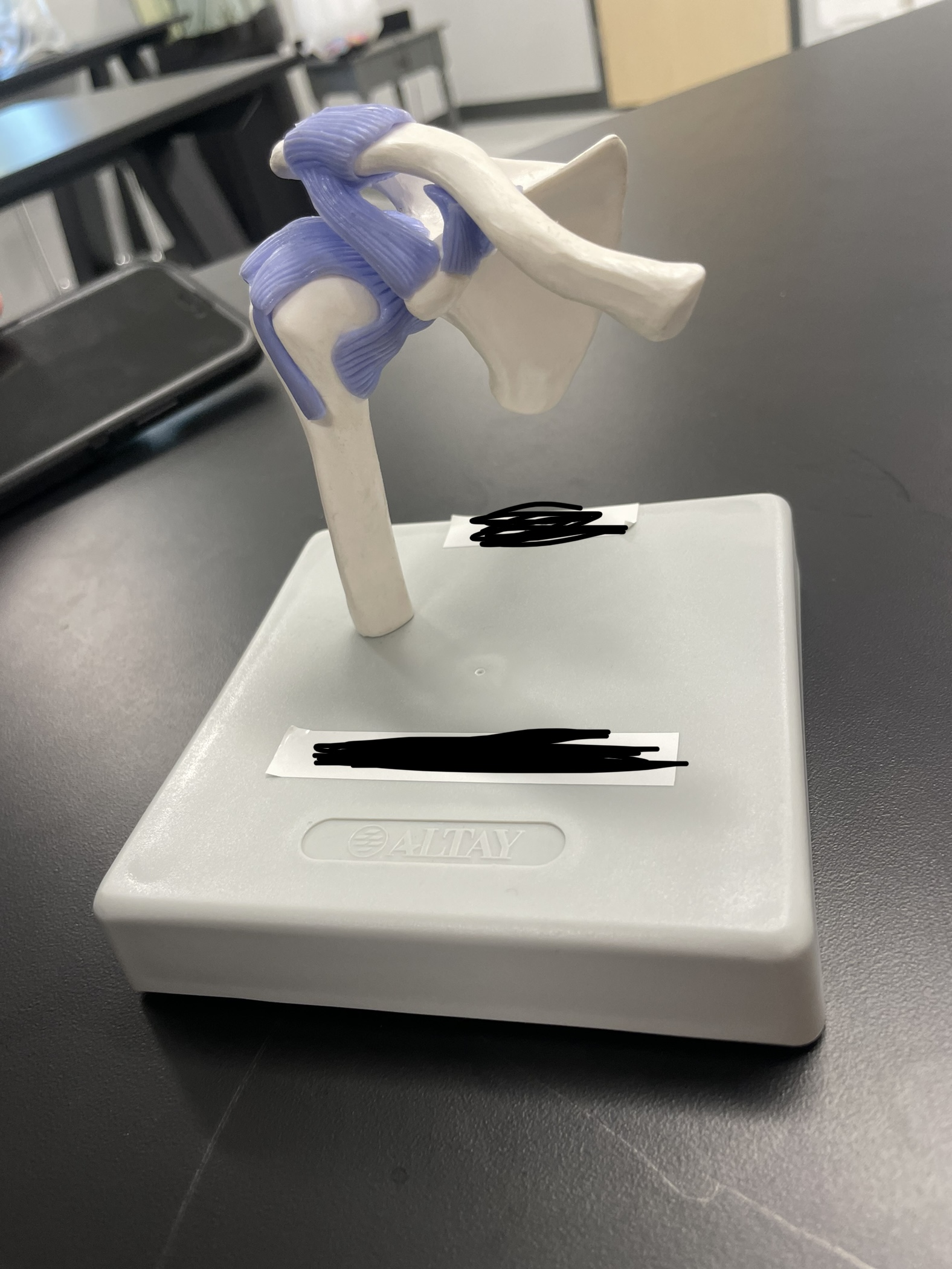 What type of joint is this