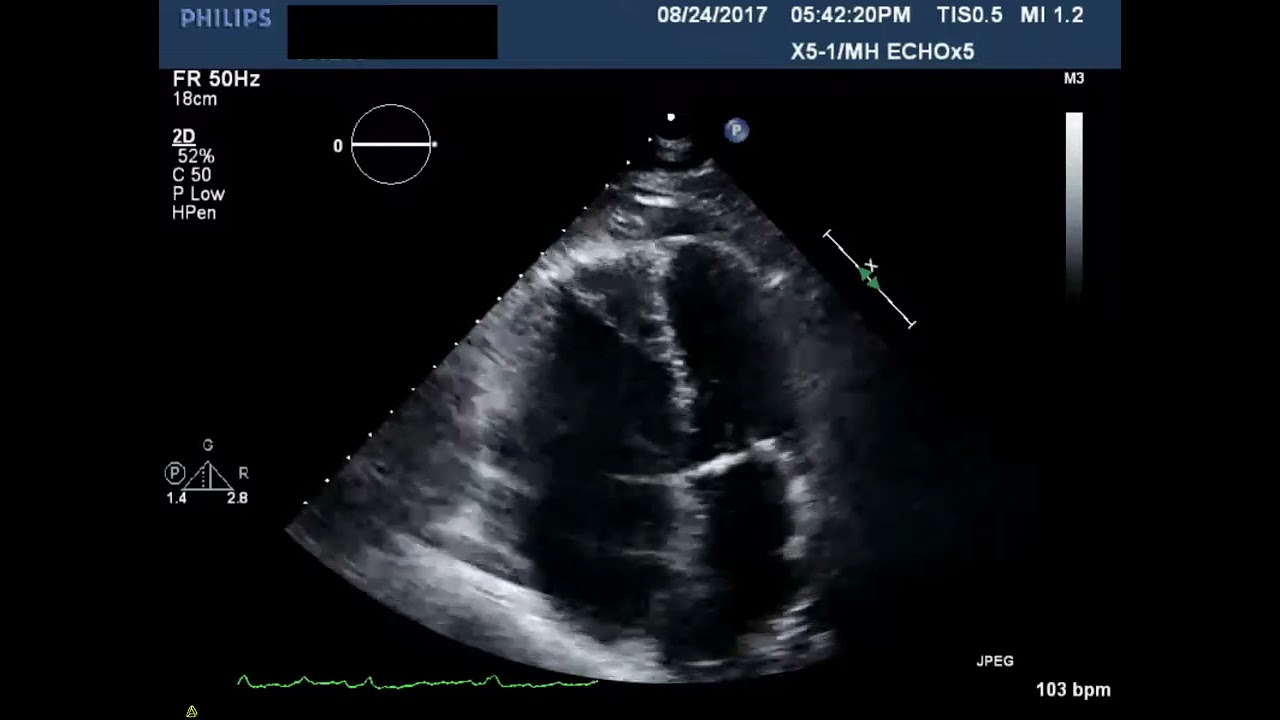 <p>What is seen in this 2D image?</p><p>What does it indicate?</p>