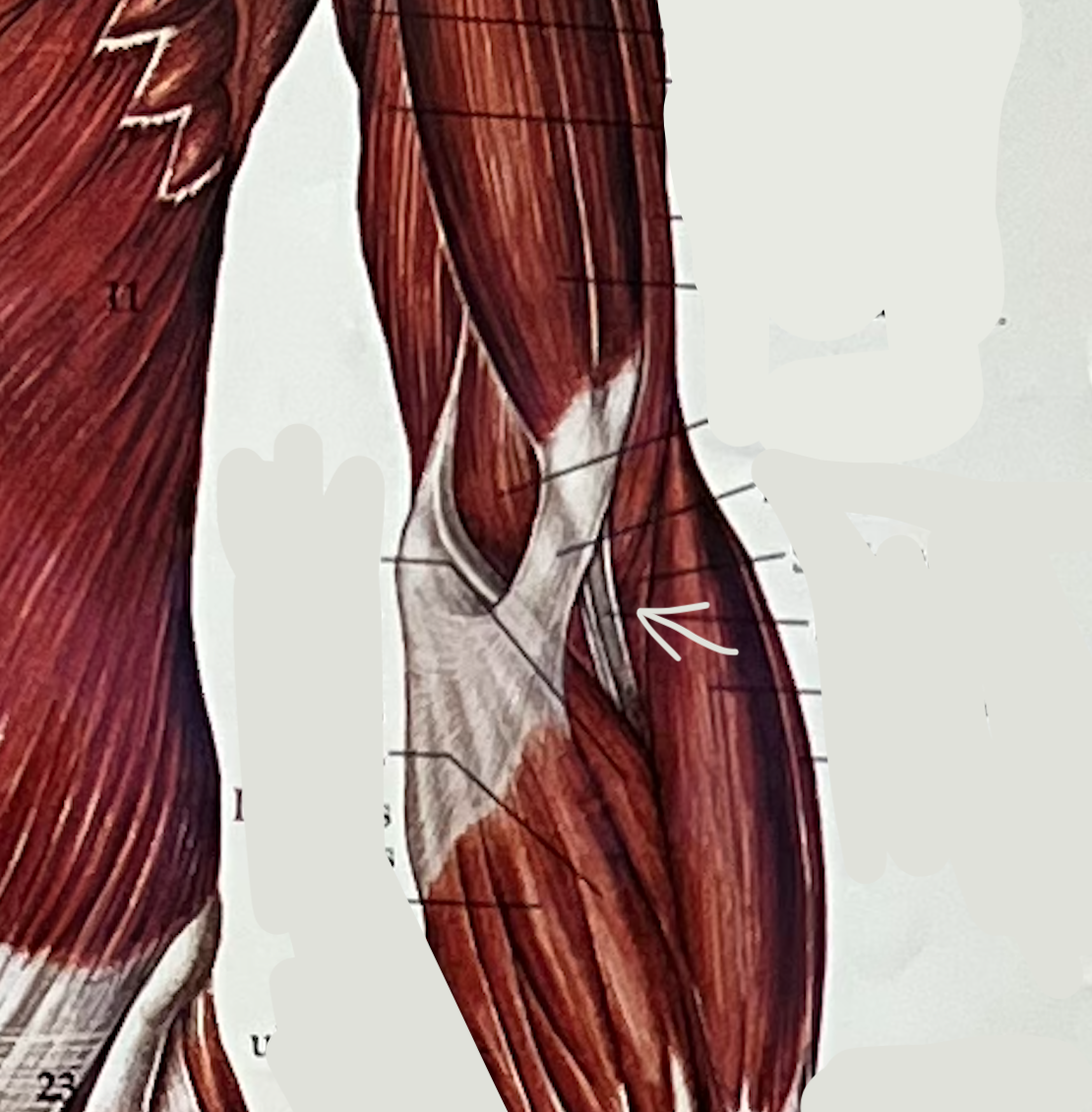 what muscle?
