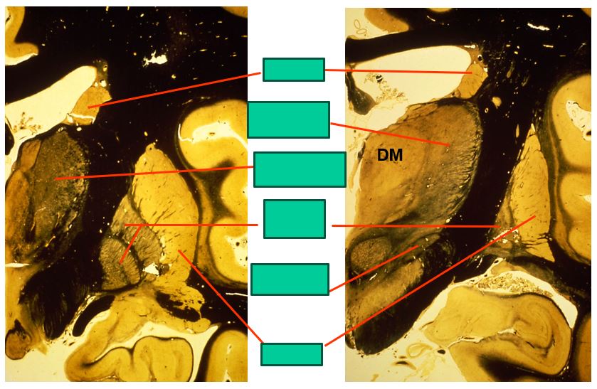 <p>the caudal level of the basal ganglia look like this</p>