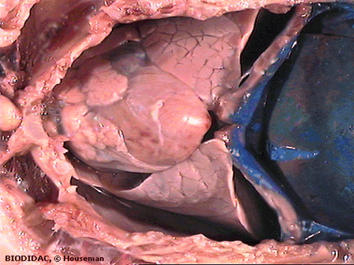 <p>Site of internal respiration—gas exchange between air and blood — Multi‑lobed organs filling thoracic cavity flanking heart</p>
