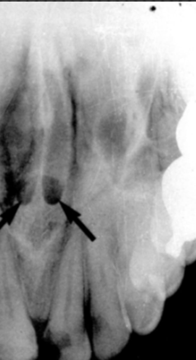 <p>Identify the structure</p>