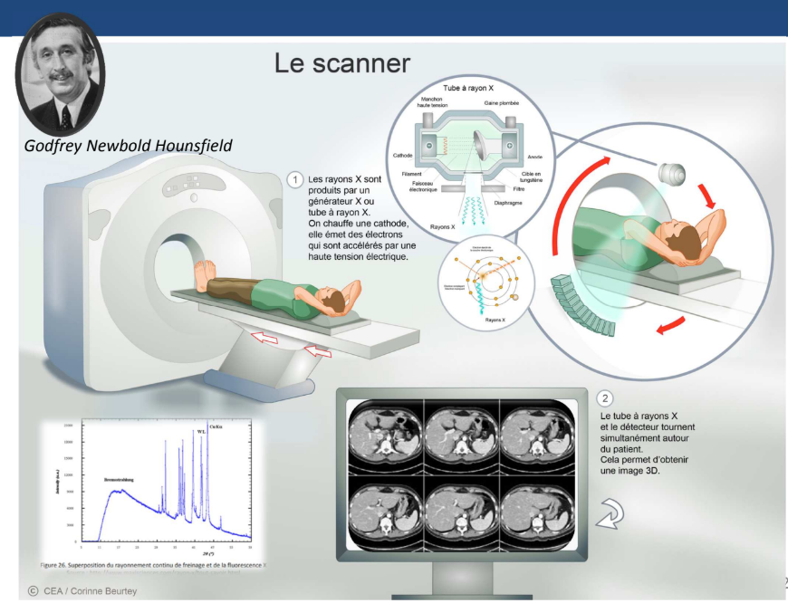 <p>Le scanner a le même principe que la radiographie mais en <strong>un peu plus évolué.</strong> Le générateur de rayon X va tourner autour du patient et le patient avance dans le champ de vue →2 mouvements</p><p>→Ca va nous permettre de générer des <span style="color: red"><strong>tranches d’images en 2D</strong></span>. Par traitement informatique, on peut ensuite <strong>reconstituer une image en 3D</strong>.</p><p>Le scanner va plus vite. On obtient un contraste meilleur donc on peut voir plus de choses mais ça irradie plus</p>