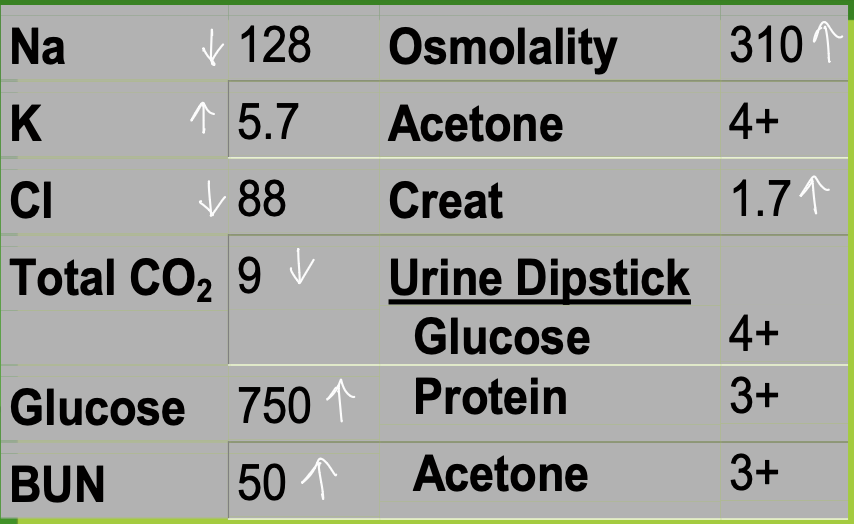 <ul><li><p>Pt has diabetic ketoacidosis</p><ul><li><p>Due to increased glucose, acetone in urine</p></li></ul></li><li><p>BUN is increased in DM due to dehydration, since urea moves with water and is retained, leading to a buildup of NPNs</p></li><li><p>Loss of body water is indicated by osmolality and decreased Na+</p></li><li><p>Glycosuria is due to being past the renal threshold</p></li><li><p><strong>Metabolic acidosis</strong></p></li><li><p><strong>ABG and pH test results:</strong></p><ul><li><p>pH decreased</p></li><li><p>pCO2 decreased</p></li><li><p>pO2 increased</p></li></ul></li></ul><p></p>