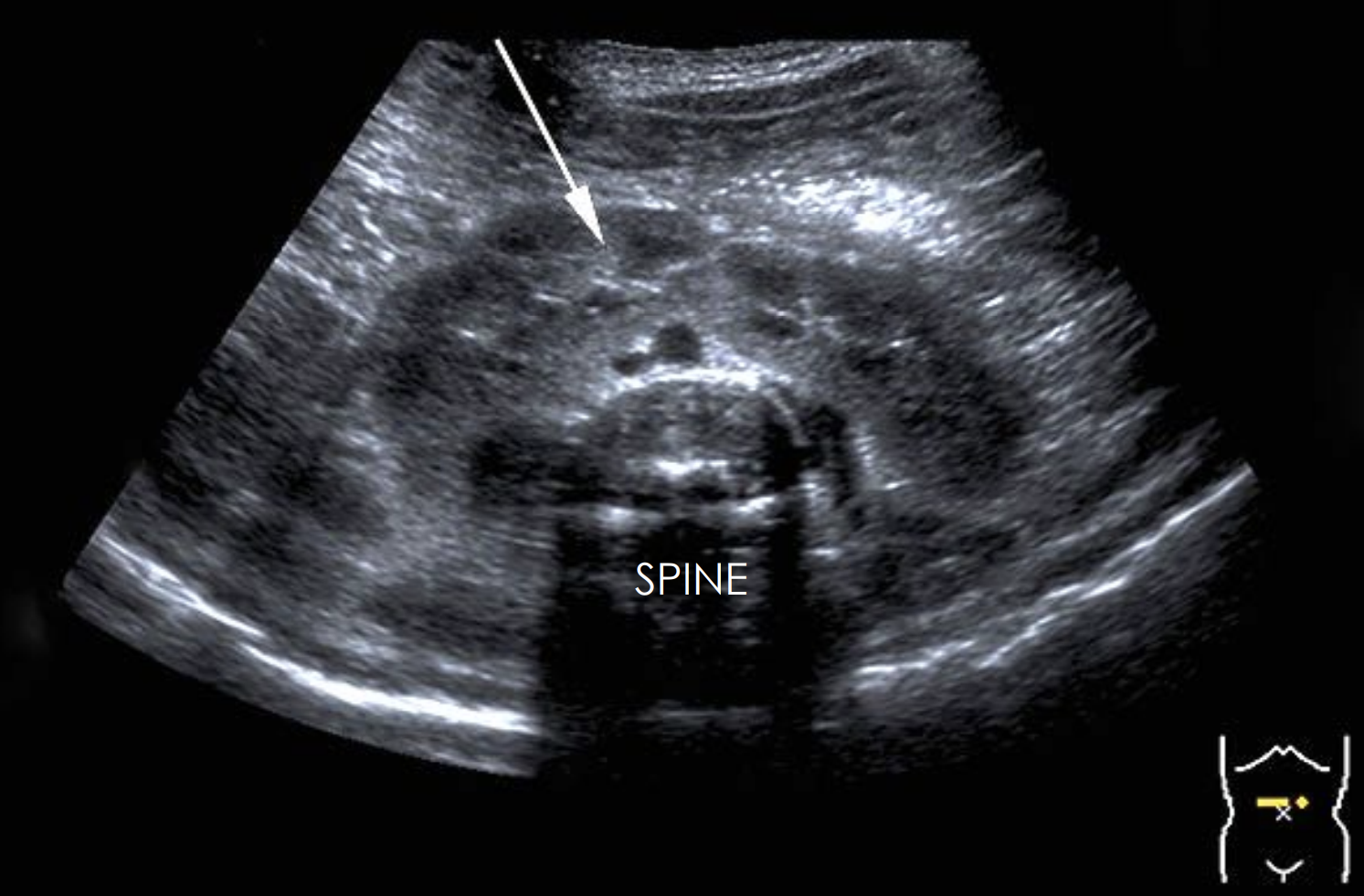 <p>Which variant is this?</p>