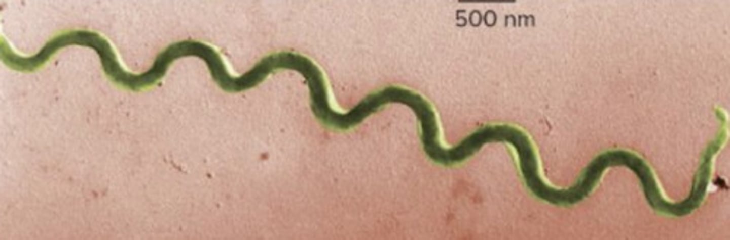 <p>chemoorganotropic bacteria (obtain energy by oxidizing organic compounds); periplasmic flagella; corkscrew like movement over surfaces</p>