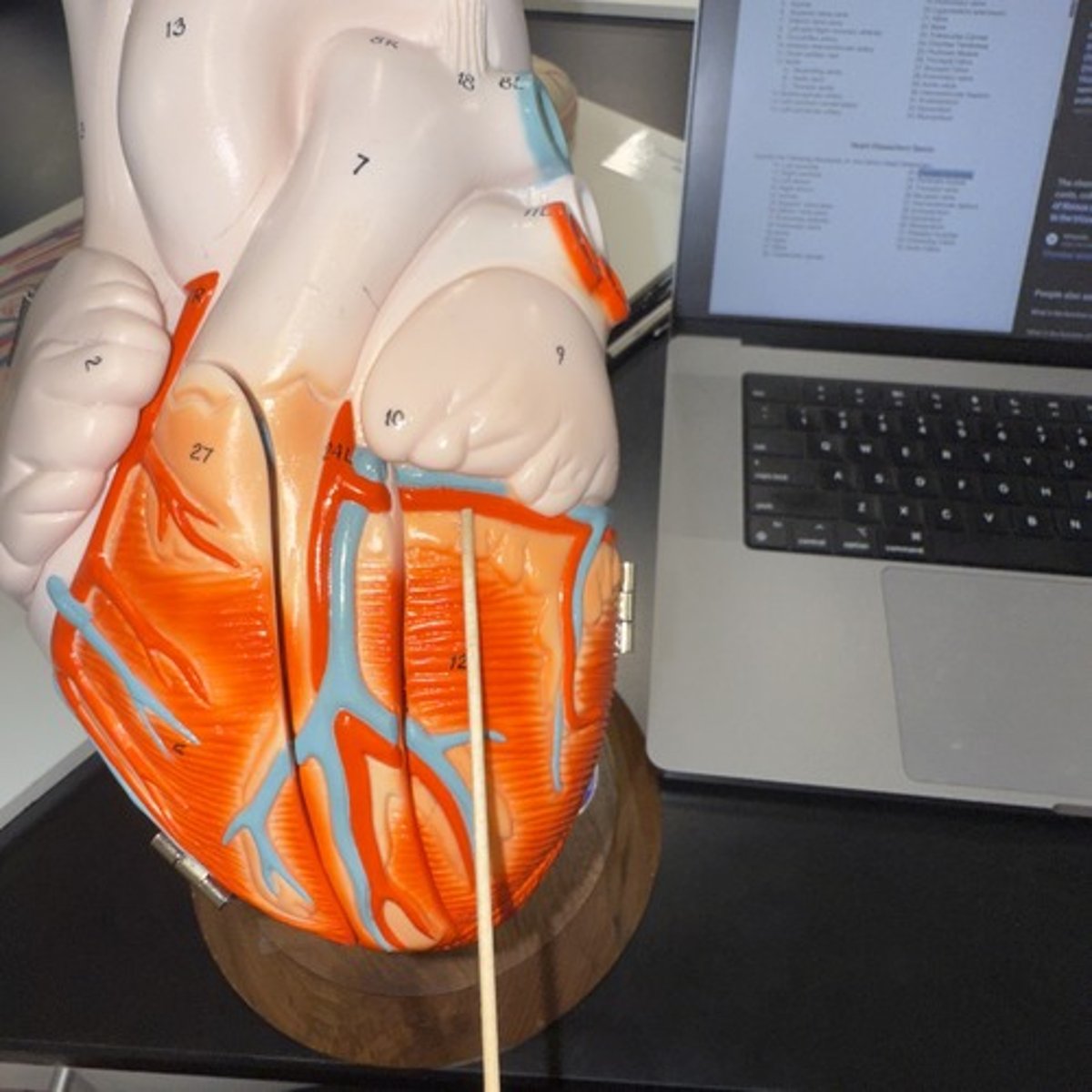 <p>Identify the structure.</p>