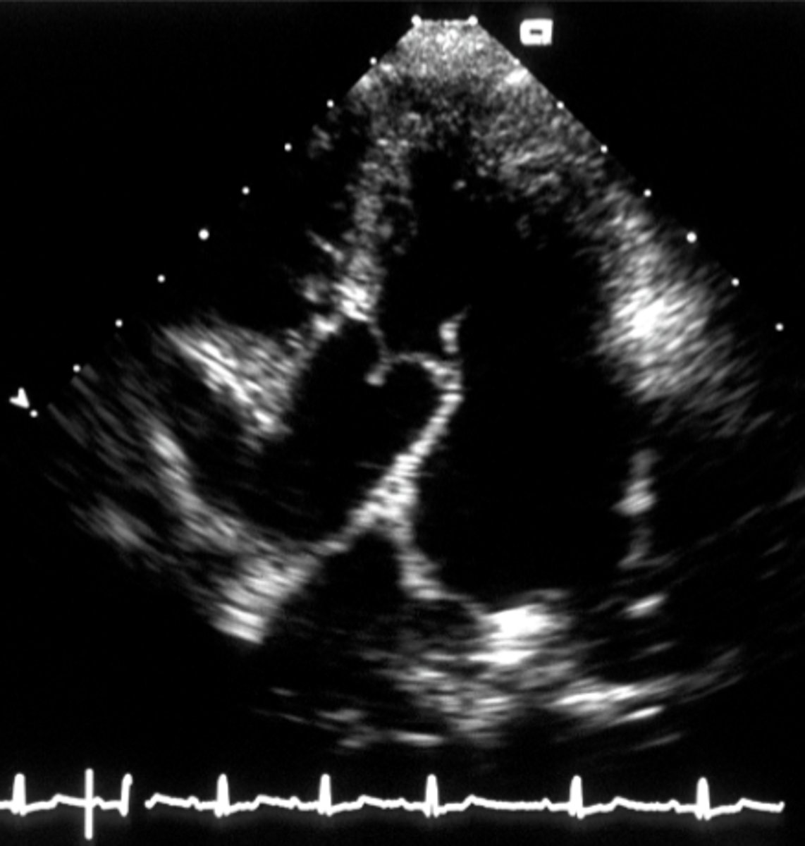 <p>aortic valve</p>