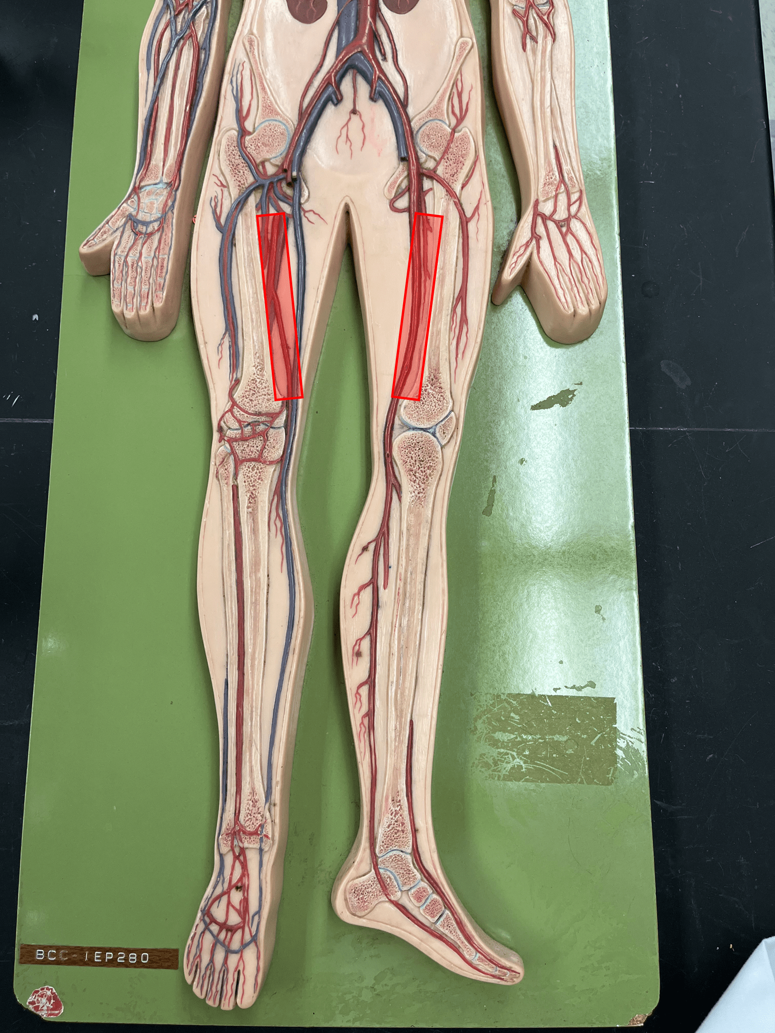 <p>• An artery of the lower limb.</p>
<p>• Originates as the continuation of the external iliac artery.</p>
<p>• Supplies the thigh muscles.</p>