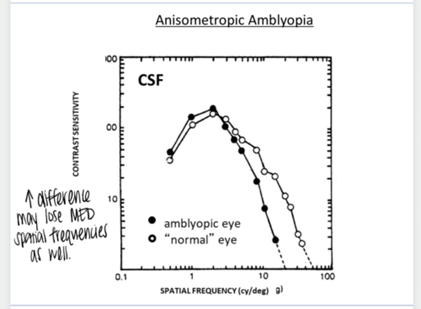 <p>Can you lose high AND med spatial frequencies with Anisometropic Amblyopia?</p>