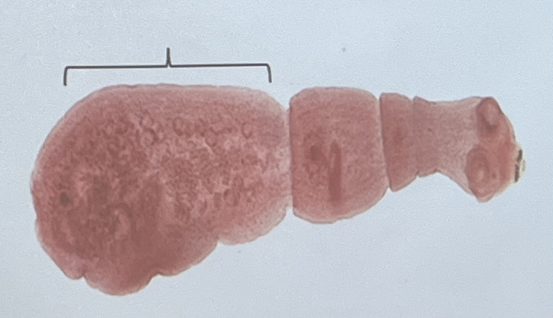 <p>What is body called and head?</p>