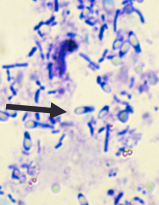 <p><span style="background-color: transparent;"><strong><span>Clostridium</span></strong></span></p>