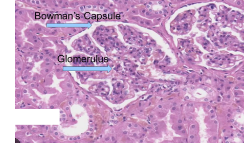 <p>Bowman’s capsule, glomerulus</p>
