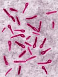<p>what is the organism</p>