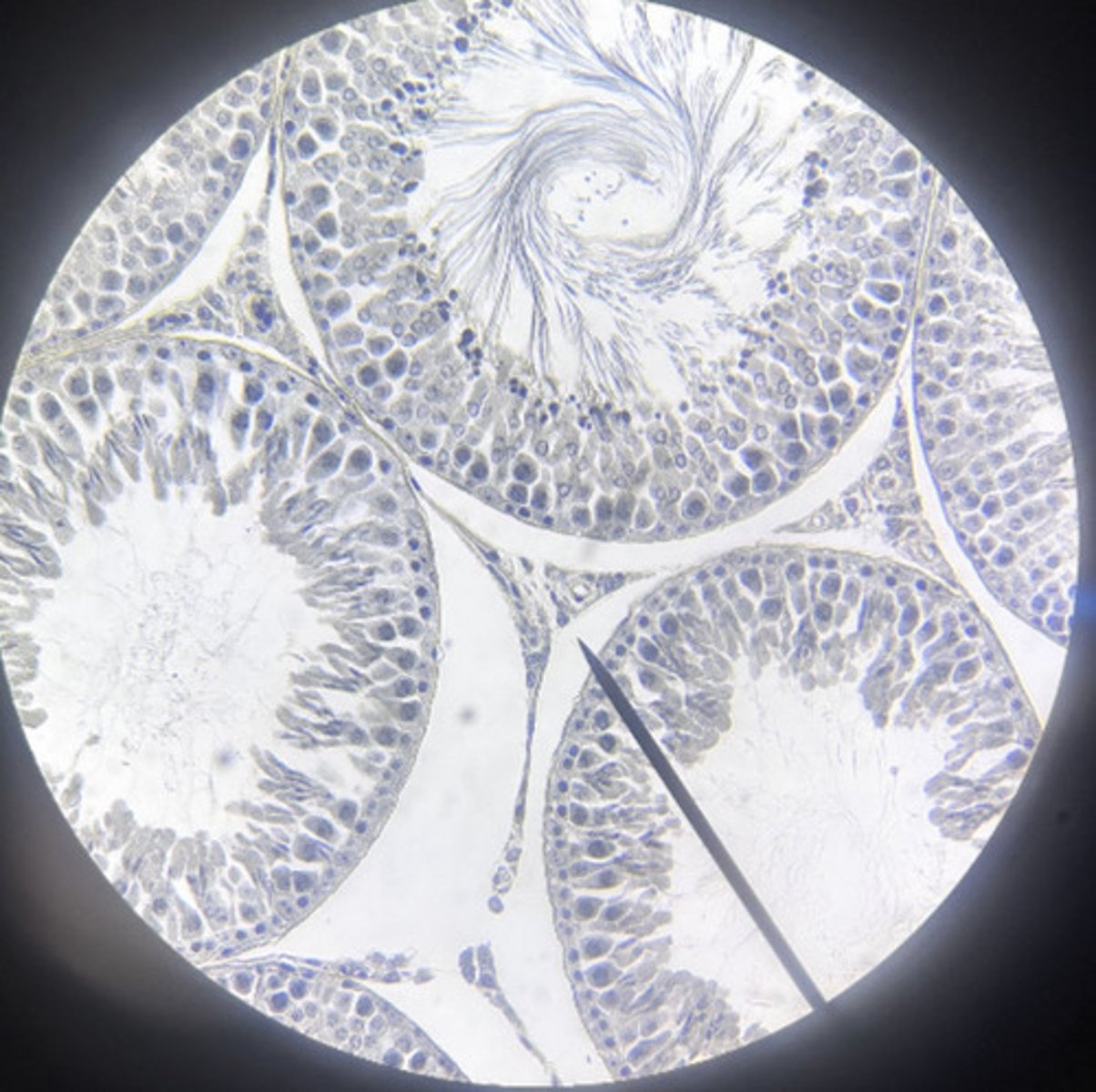 <p>what hormone does this gland secrete?</p>