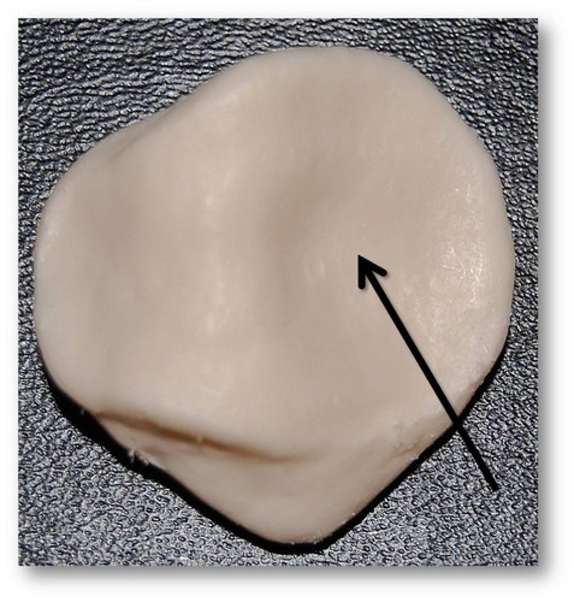 <p>Name the joint projection: </p>