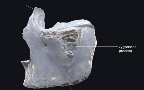 <p>Zygomatic Process of the maxilla </p>