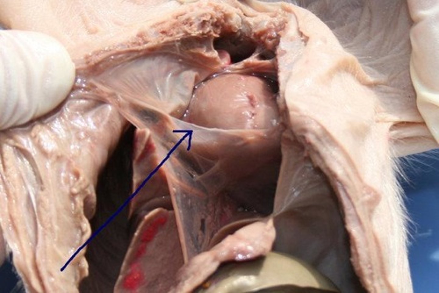 <p>membranous sac enclosing the heart</p>