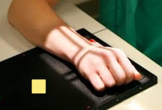 <p>PA wrist</p><ul><li><p>hand in light fist</p></li></ul><p></p>