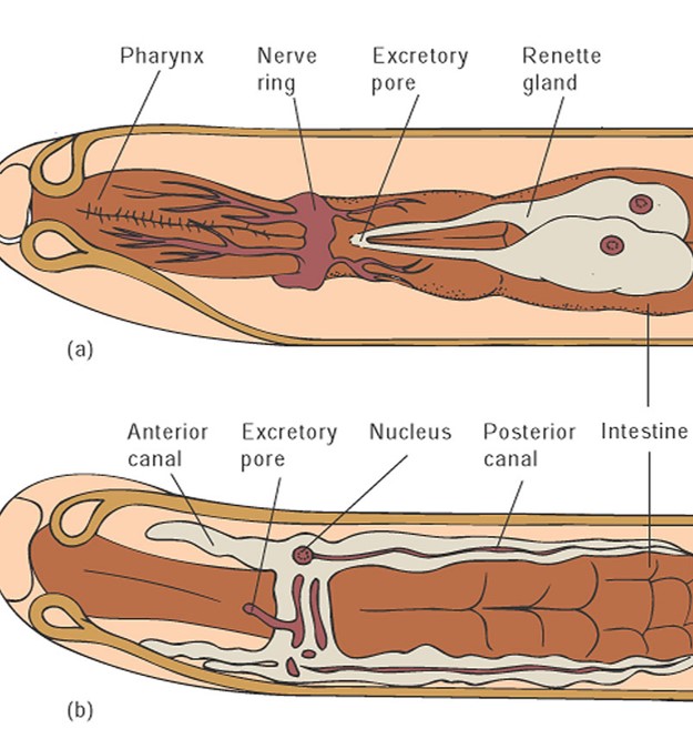 relatively complex nerve ring 