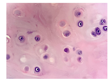 <p>type of cartilage</p>
