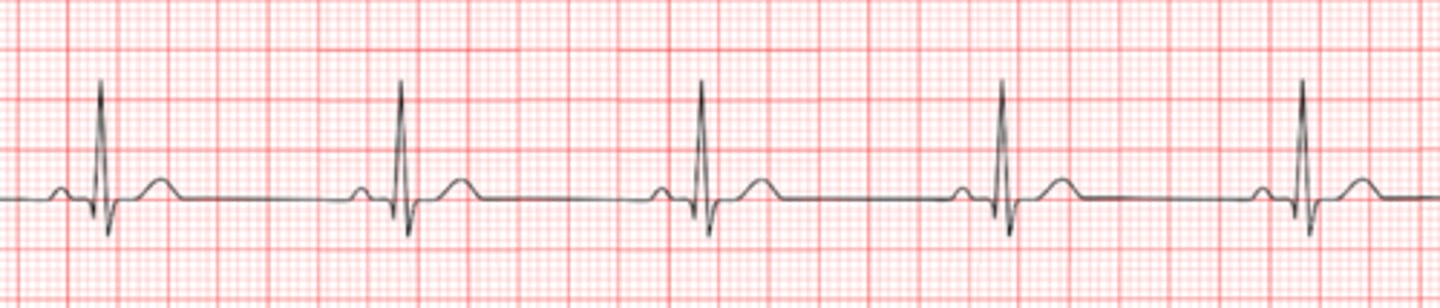 <p>Name the rhythm</p>