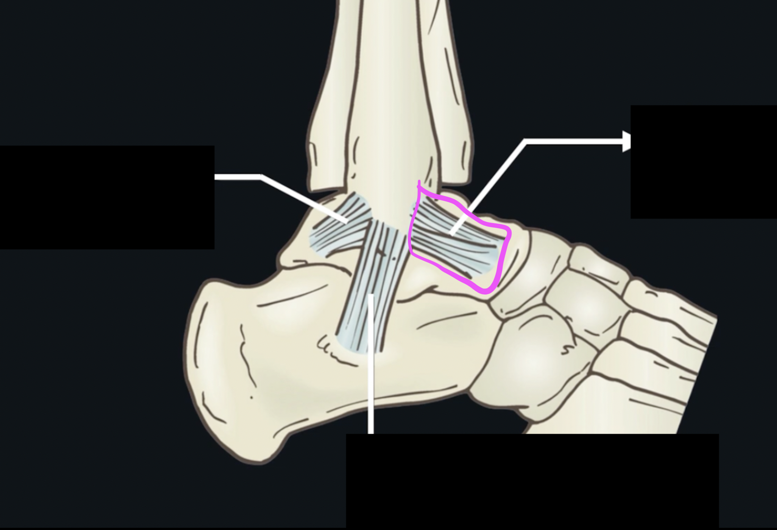 <p>What ligament is this? </p>