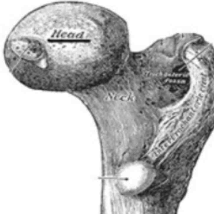 <p>cat #2 / bony expansion carried on narrow neck / femoral head</p>