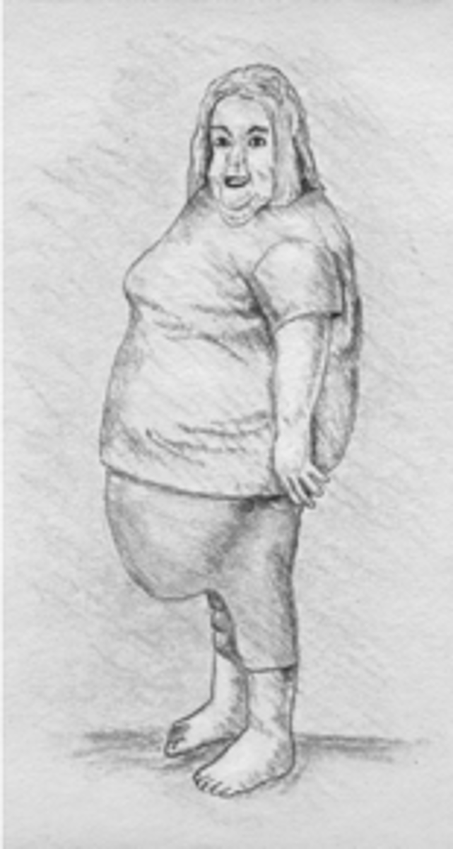 <p>a large protuberant abdominal skinfold</p>