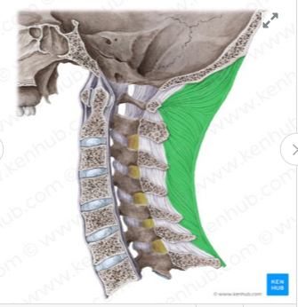 knowt flashcard image