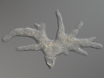 <p>Phylum: Unikota<br>Amoeabazoan</p><p>Freeliving/Parasitic Heterotroph</p><p>Unicellular</p><p>Amorphous<br>Blunt Pseudopod<br><br>Naegleria fowleri<br>Entamoeba</p>