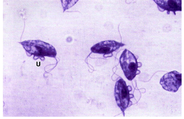 <ul><li><p>Sexual transmission, use AI to prevent transmission</p></li><li><p>Three anterior flagellum</p></li><li><p>One posterior flagella</p></li><li><p>Causes vaginitis, endometriosis, pyometra and abortion</p></li></ul>