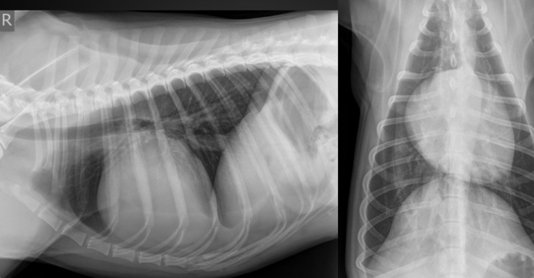 <p>What are the radiographic findings?</p><p>Diagnosis?</p>