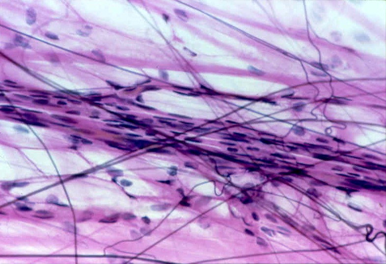 <p>What are the thin black lines?</p>
