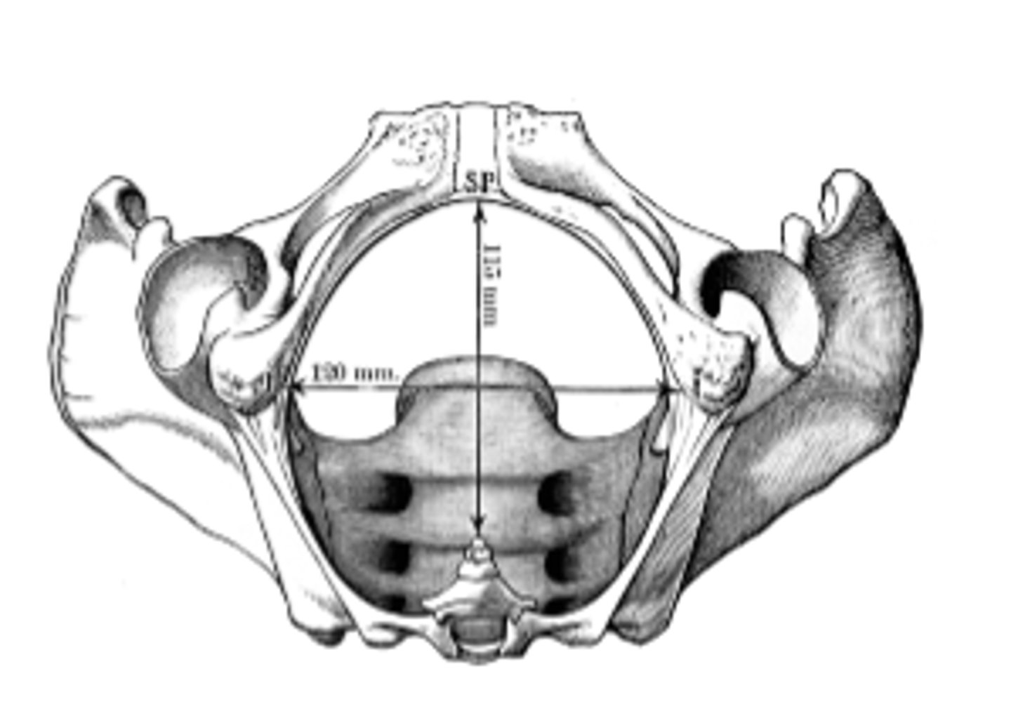 <p>-Tip of coccyx (posterior)<br>-Sacrotuberous ligament (posterolateral)<br>-Ischial tuberosities (anterolateral)<br>-Pubic symphysis (anterior)</p>