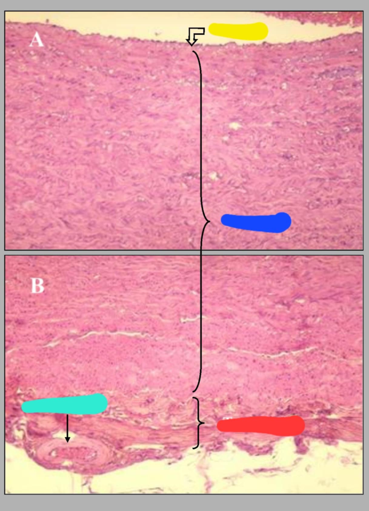 <p>Name of the slide. State the parts.</p>