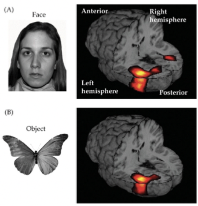 <p>Measures tiny magnetic fields given off by active neurons through magnetism</p>