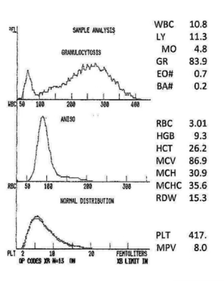 <p>what type of anemia is present?</p>