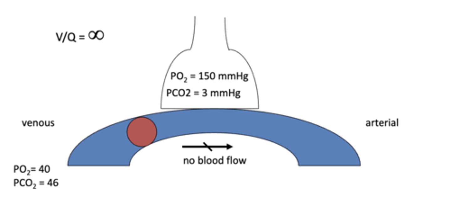 <p>alveolar dead space = no gas exchange ==&gt; O2 and CO2 in the alveoli will come in and go staright back out</p>