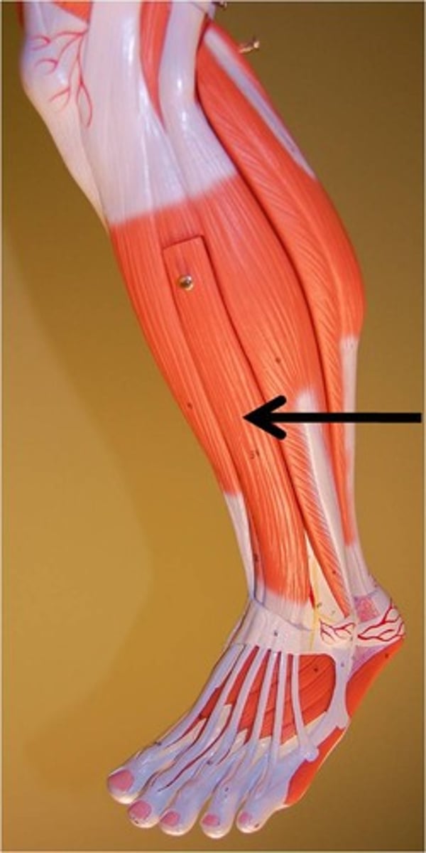 <p>A muscle that extends the toes and dorsiflexes the foot.</p>