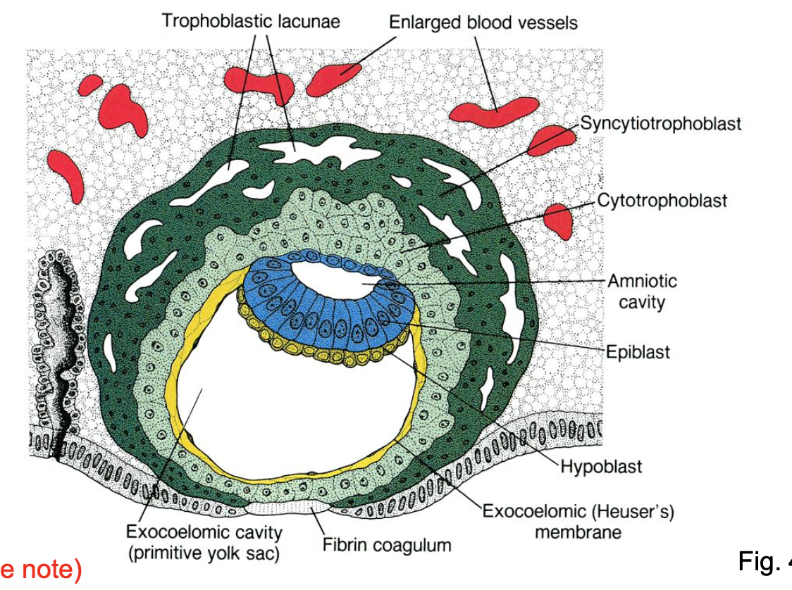 <ul><li><p>amniotic cavity, embryonic disc (bi-layered), trophoblastic lacunae &amp; primitive yolk sac</p></li></ul><p></p>