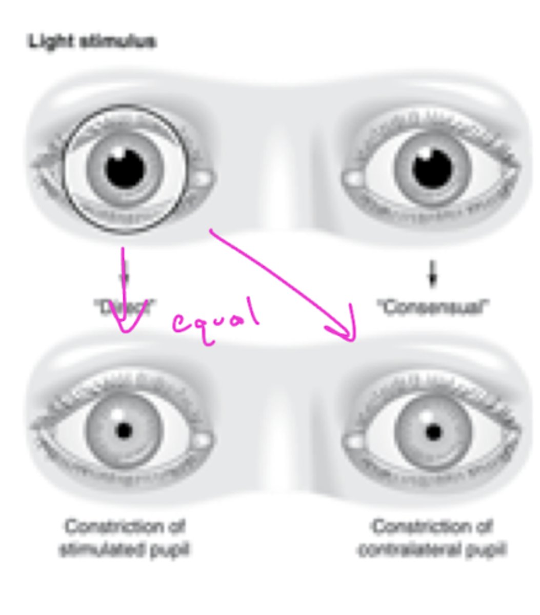 <p>eye without light consensually constricts (magnitude should be the same)</p>