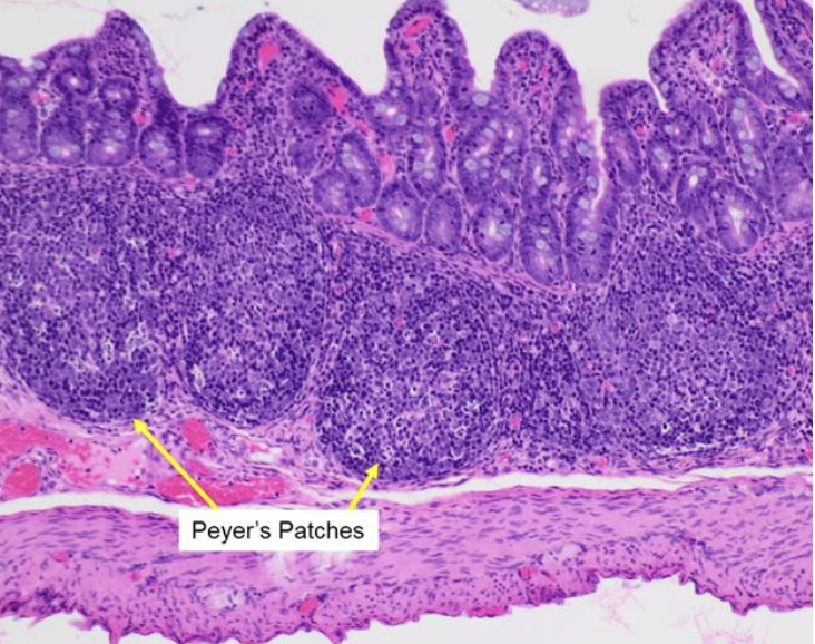   	 		 		 	 	 		

**True or False**

**Peyer’s patches** are aggregated lymphoid nodules in submucosa / mucosa of small intestine  ?	 