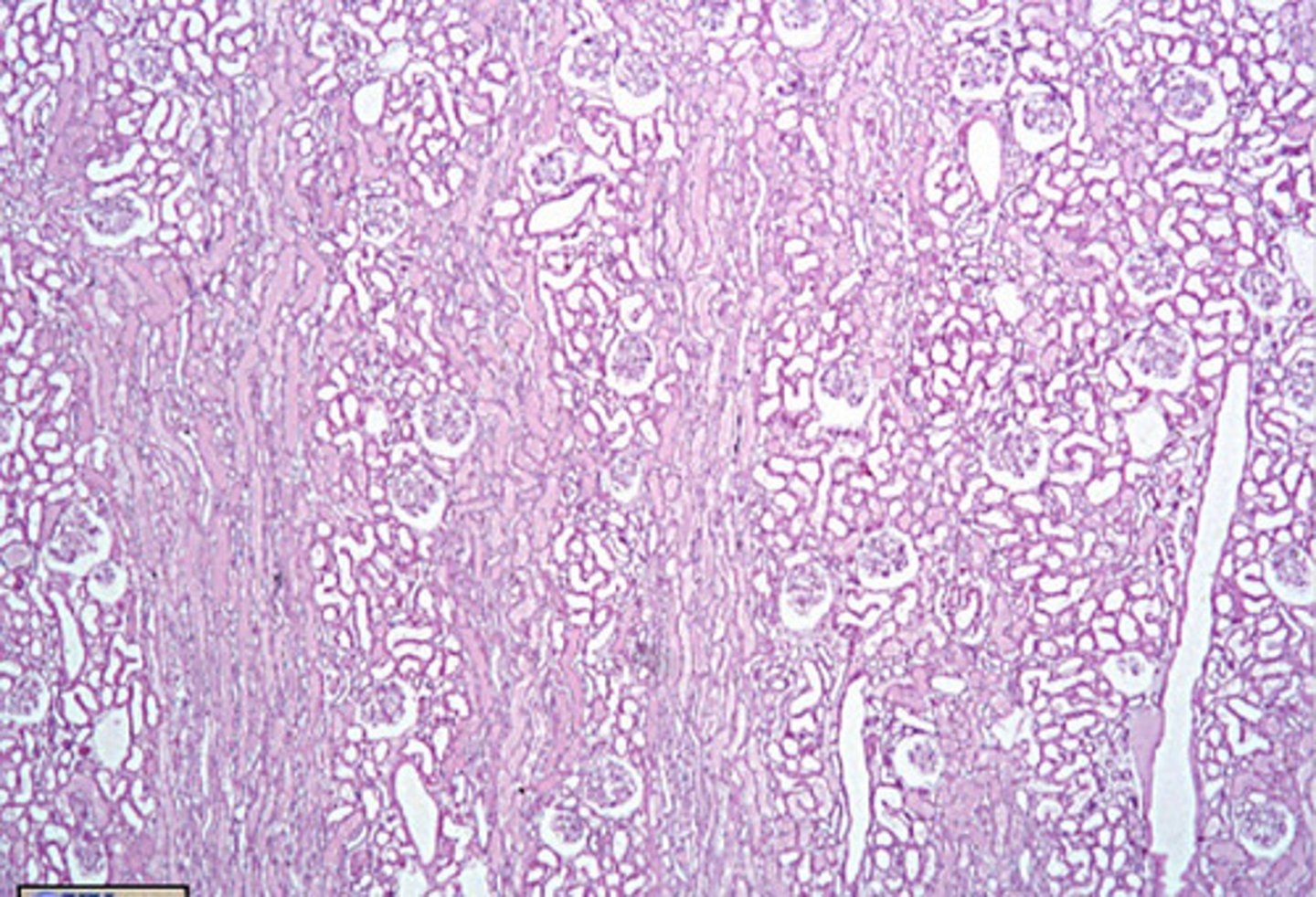 <p>is this the cortex or medulla?</p>