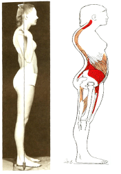 <p>Kyphotic-Lordotic Posture:</p>