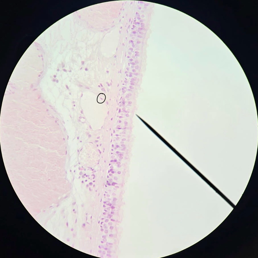 <p>Simple Squamous Epithelium</p>